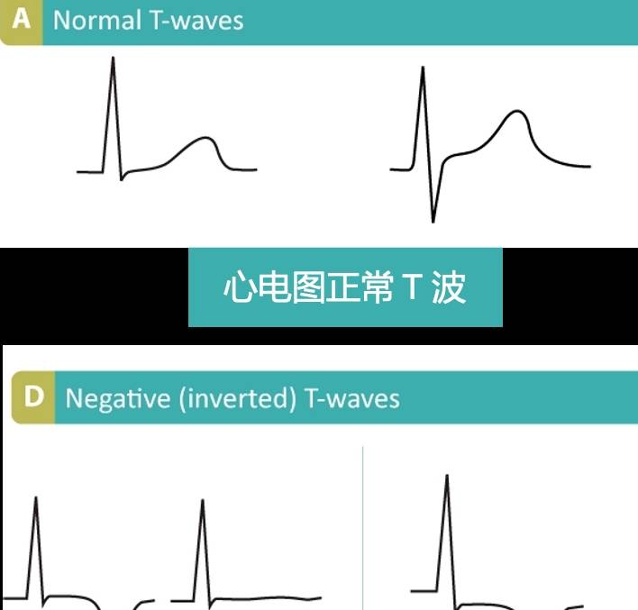 年轻人如何有针对性的体检