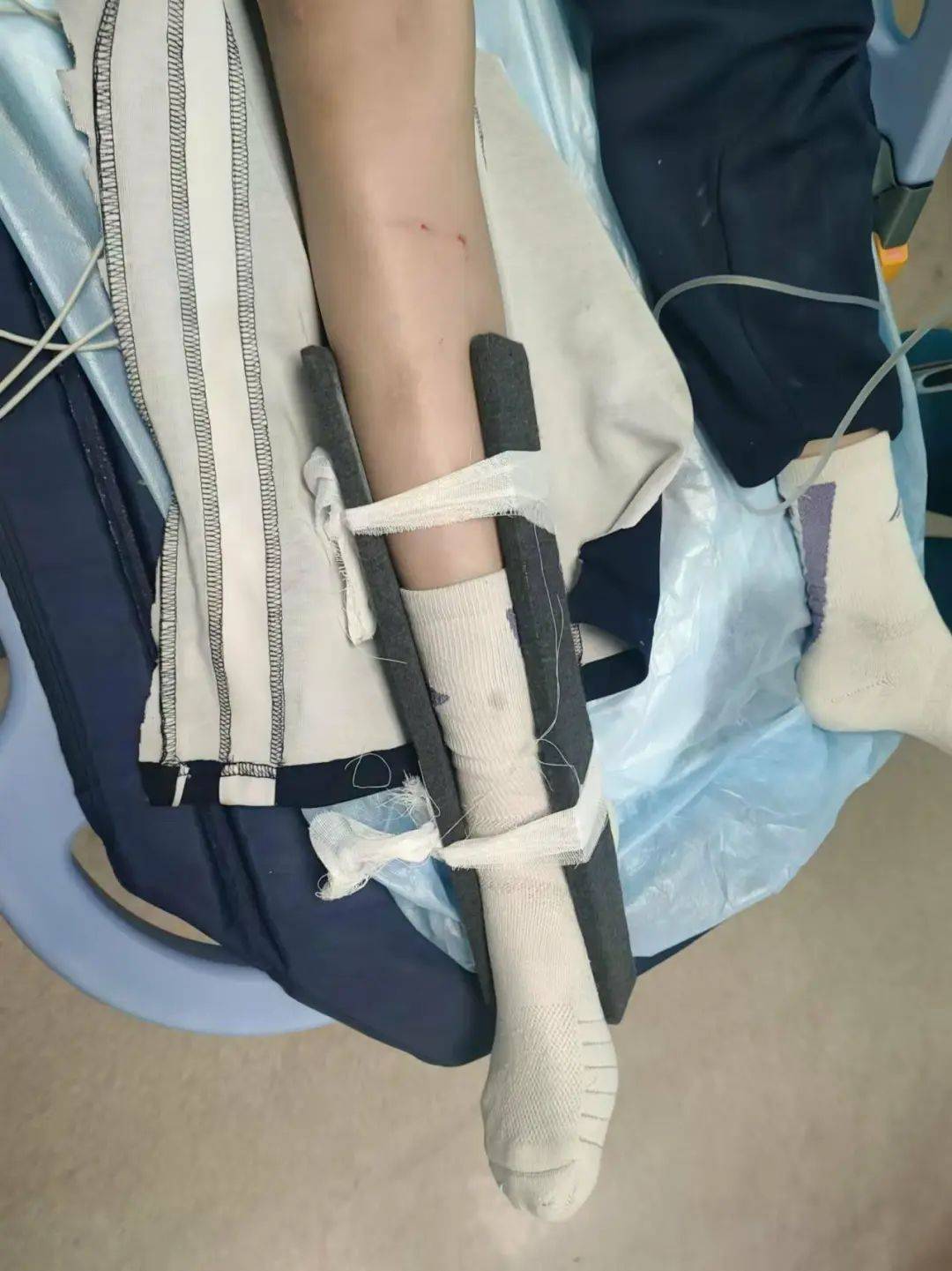 惨痛<strong></p>
<p>币管家交易所</strong>！一人身亡！深圳多名学生骑电动车发生意外
