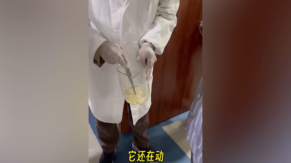 女子肛门处刺痒难忍<strong></p>
<p>中币交易所如何登录</strong>，医院用“南瓜籽+槟榔”驱虫排出长达10米寄生虫