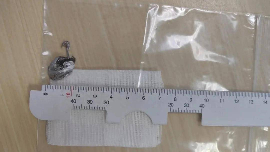 700°C<strong></p>
<p>交易所债券交易规则</strong>！浙江男子瞬间失明！紧急提醒