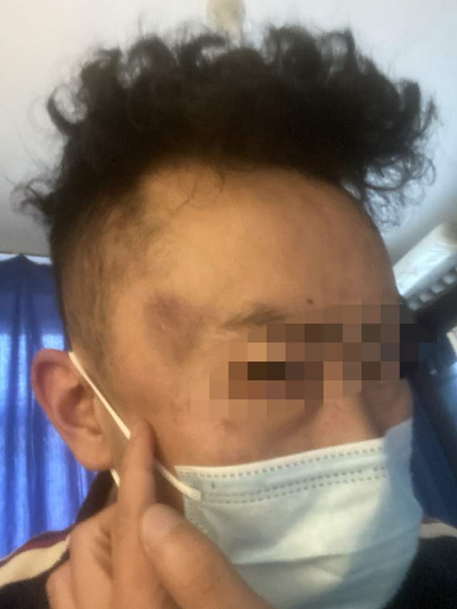 母亲未做核酸遭民警责骂<strong></p>
<p>币杰交易所</strong>，男子插话后被群殴，涉案3名警员公开受审