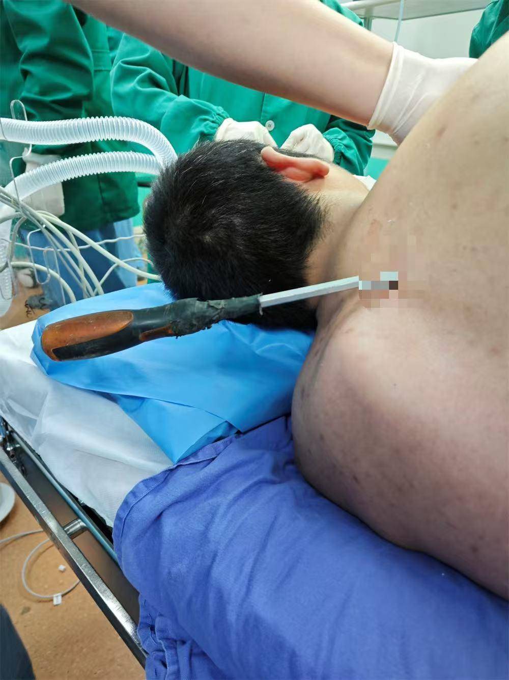 20米高空掉落螺丝刀直插男子胸腔<strong></p>
<p>币安交易所下载</strong>！医生：不要自行拔除