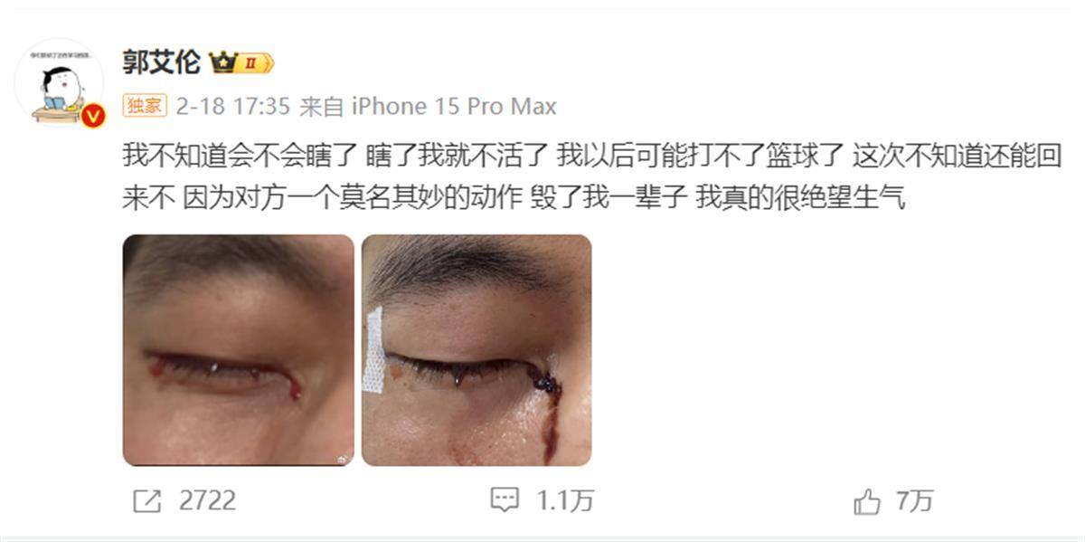 郭艾伦发文报平安：已顺利拆线<strong></p>
<p>IX交易所</strong>，相信一定会重回球场