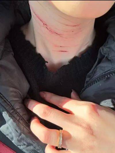 前男友公开金赛纶自残照<strong></p>
<p>币全交易所</strong>，称她的死与金秀贤无关