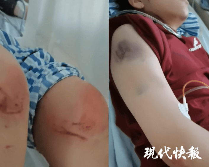 石家庄被家暴女子驾车逃跑致丈夫身亡<strong></p>
<p>币汇</strong>，一审以故意杀人罪获刑11年