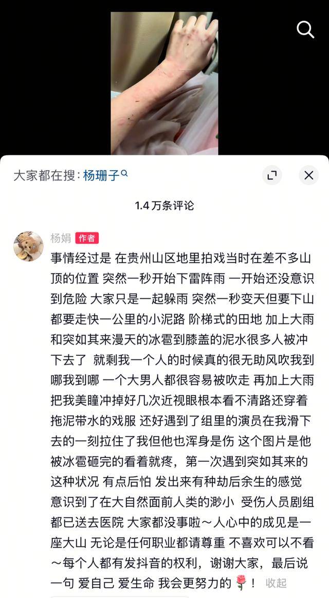 女演员贵州拍戏遇极端天气<strong></p>
<p>中币交易所网址</strong>，被冰雹砸伤！剧组伤员已送医