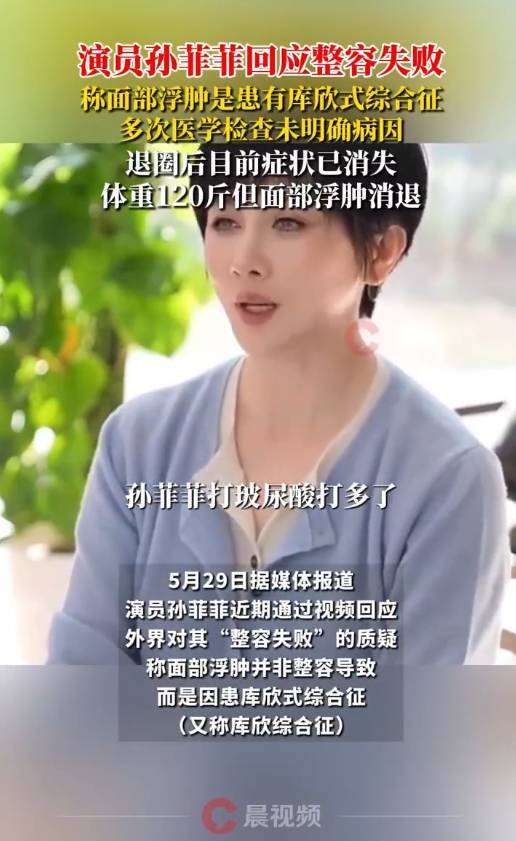 演员孙菲菲回应整容失败<strong></p>
<p>金特币交易平台</strong>！称容貌变化是因为患“库欣式综合征”