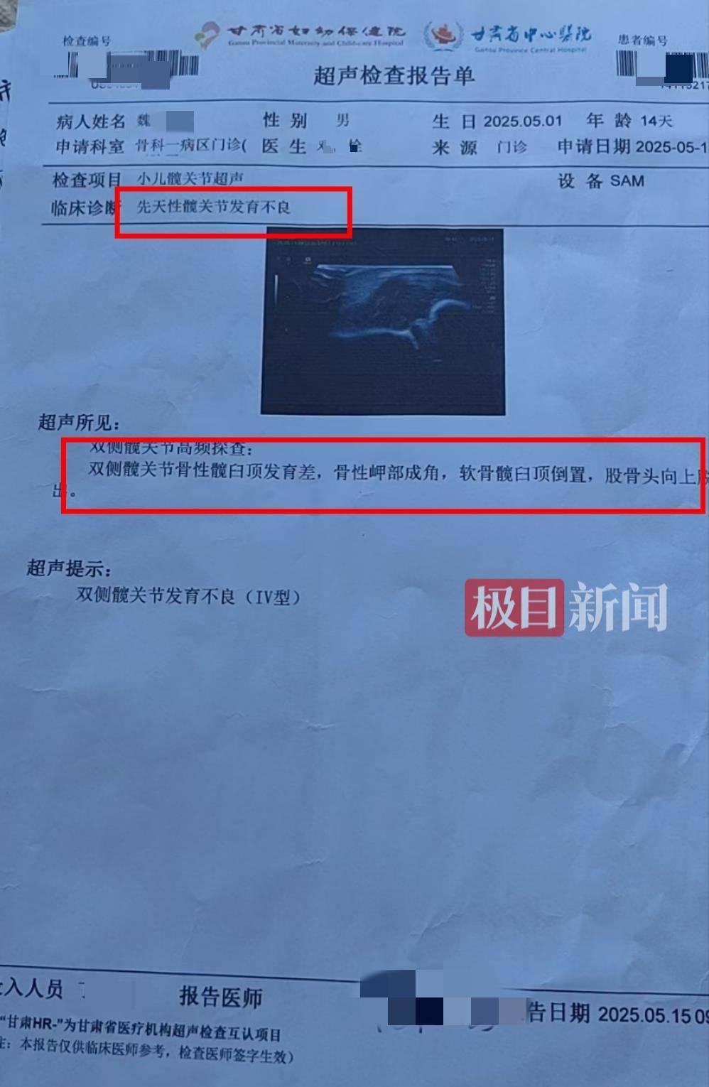 二胎出生查出先天性病症或落下残疾<strong></p>
<p>币币交易平台优势</strong>，残疾父母称医院产检漏检、未尽告知义务，医院及医调委回应