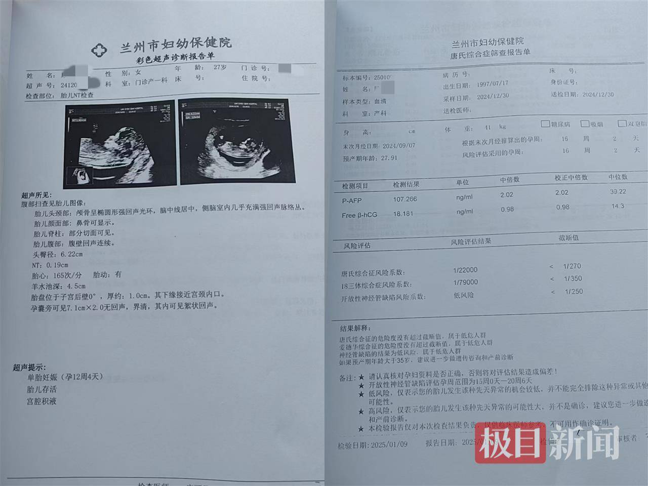 二胎出生查出先天性病症或落下残疾<strong></p>
<p>币币交易平台优势</strong>，残疾父母称医院产检漏检、未尽告知义务，医院及医调委回应