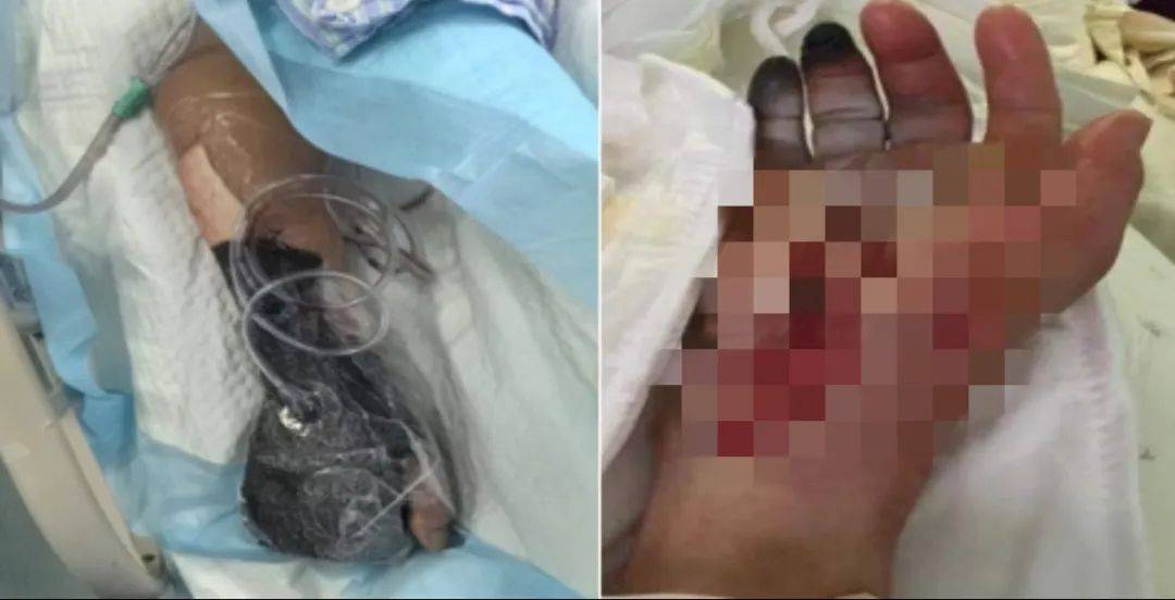 戴手套！戴手套！死亡率近100%<strong></p>
<p>zb货币交易平台</strong>，浙江已有人中招