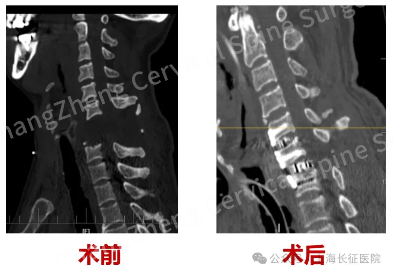 全球罕见<strong></p>
<p>中国石油股票代码</strong>！中国医生救回“身首离断”患者
