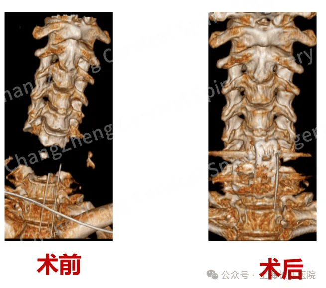 全球罕见<strong></p>
<p>中国石油股票代码</strong>！中国医生救回“身首离断”患者