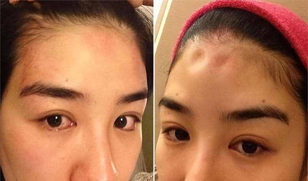 罗霖被家暴17年<strong></p>
<p>深高速股票</strong>,蓝洁瑛遭性侵暴力还被围观!女明星的暴力事件还有很多