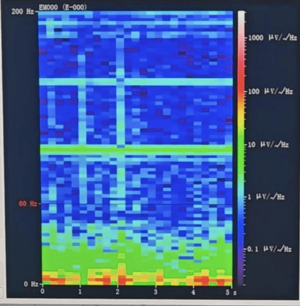 山西首例<strong></p>
<p>连云港股票</strong>！山西省人民医院成功实施脑机接口辅助功能区脑肿瘤切除手术